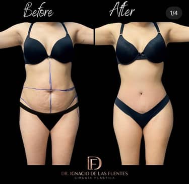 Slider image (9) Dr. Ignacio De Las Fuentes